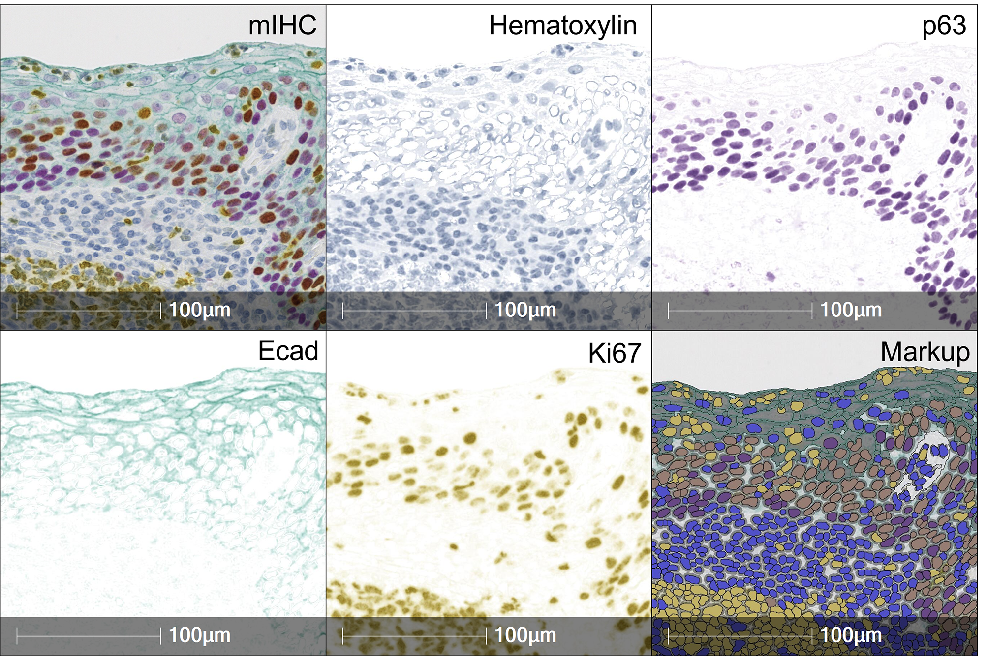 Getting Started with RNAscope™ Image Analysis in HALO® - Indica Labs