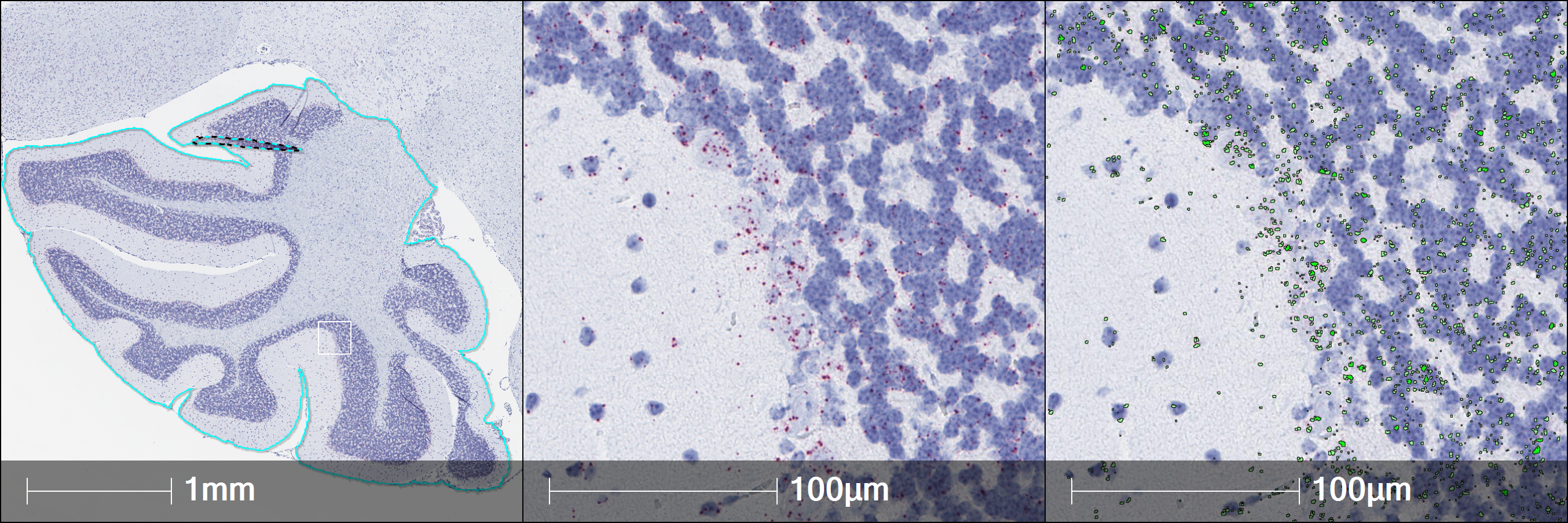 Getting Started with RNAscope™ Image Analysis in HALO® - Indica Labs