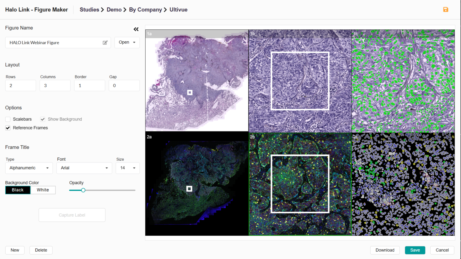 Multiple histopathology slides are displayed, with overlays indicating AI-based cancer detection and biomarker quantification, highlighting the use of the Halo Link AI system for analyzing lung, breast, and colorectal cancer tissues.