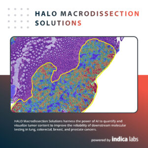 The image shows a colorectal cancer tissue specimen with a heat map of concentrated tumor cells and a yellow annotation line.