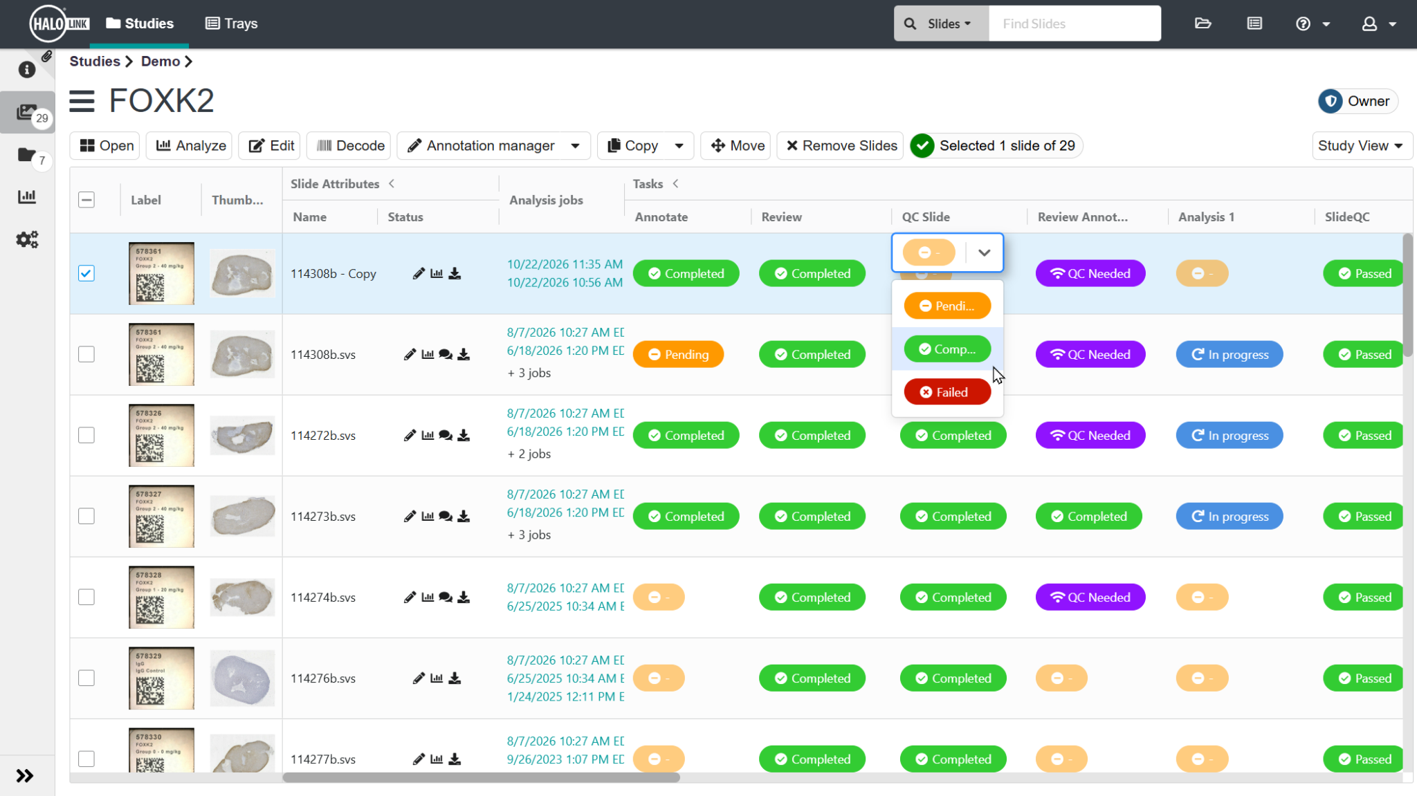 From Image to Insight: Automating Biomarker Research Workflows with ...