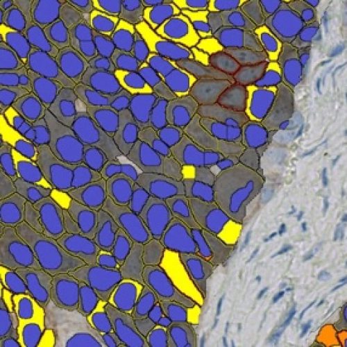 AI-Powered Subcellular Localization