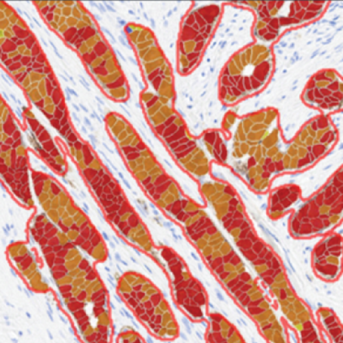 Breast IHC AI Feature Image