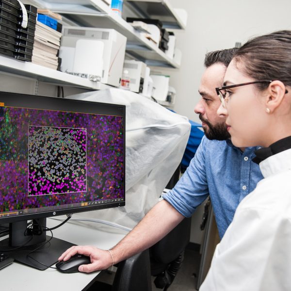 HALO offers unmatched ease-of-use and scalability, powerful analytic capabilities, and the fastest processing speeds available among digital pathology image analysis software.